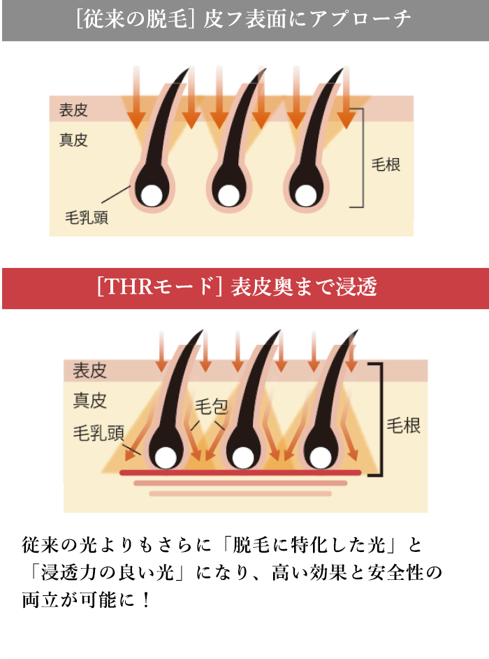 [THRモード]表皮奥まで浸透。「従来の光よりもさらに特化した光」と「浸透力の良い光」になり、高い効果と安全性の両立が可能に。